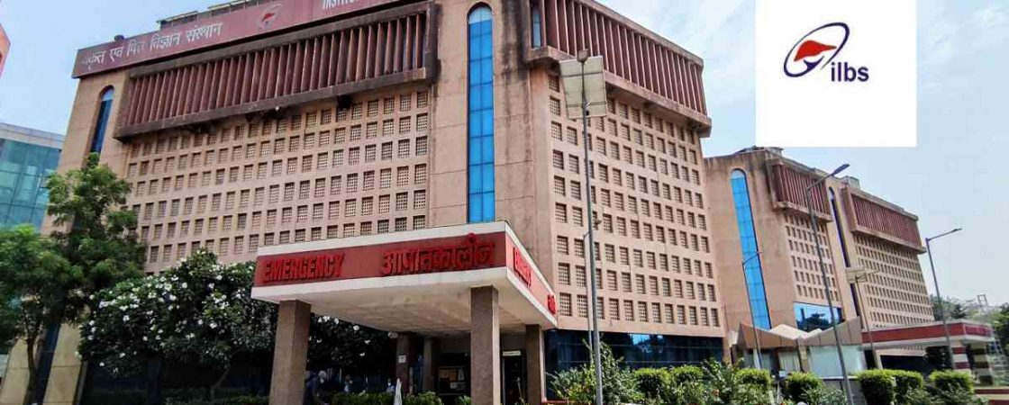 ILBS Hospital Delhi